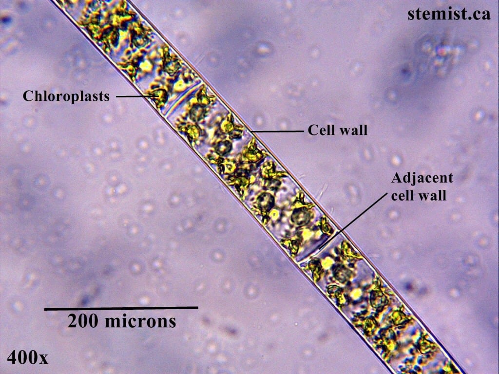 Above: Filamentous algae at 400x magnification. These cells are much larger and more complex than the cyanobacteria.