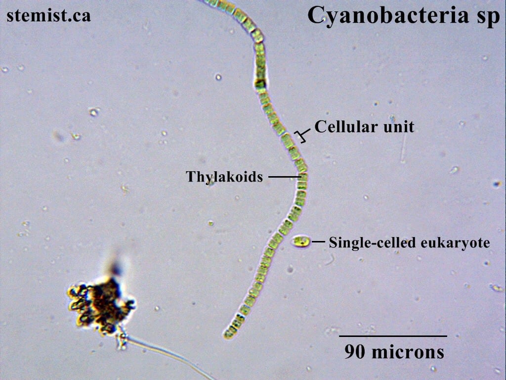 Above: Cyanobacteria at 400x. The individual cells form long chains.